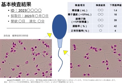 ちゃんと知りたい男性のカラダ | 避妊のススメ