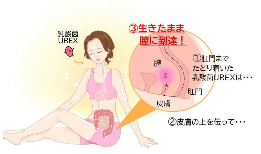 骨盤臓器脱 ―シニア女性の生活の質を下げる子宮脱、膀胱瘤、直腸瘤―｜京都済生会病院