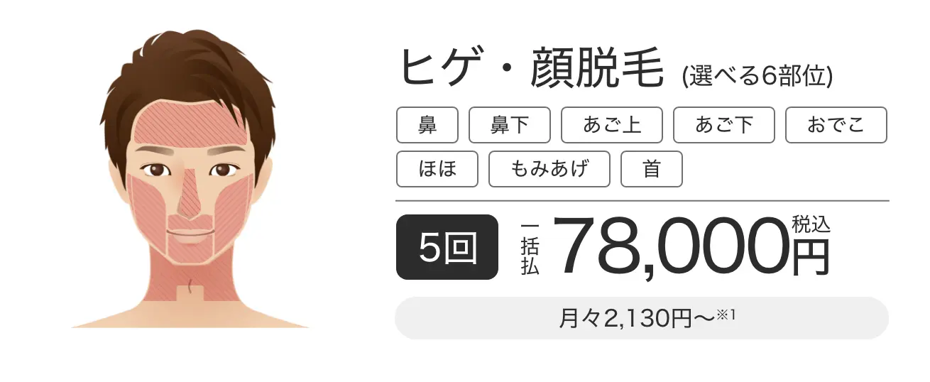 メンズ脱毛の値段が安いのは？コスパ、総額費用を相場の料金と比較 | 芦屋脱毛ミコラ【公式】