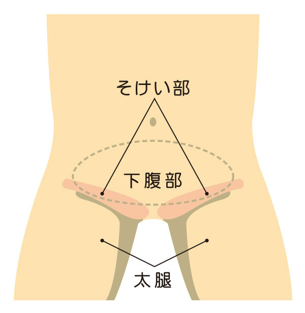 ソケイヘルニア外来 | 上福岡総合病院