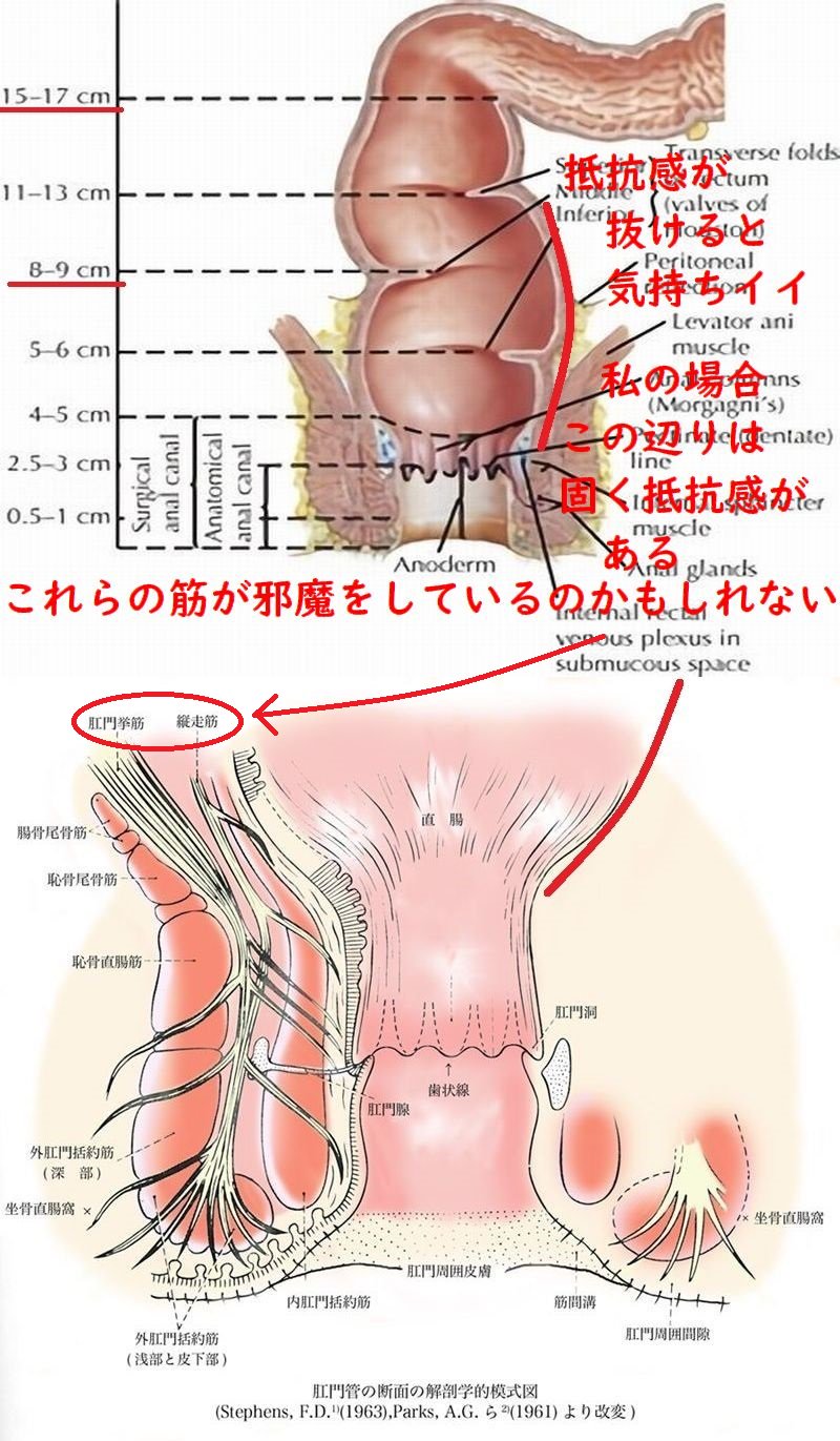 ２穴Ｓ字絶頂】腋毛とケツ毛の剃り残しの無防備恥帯！無邪気なFcup巨乳しょうじょと壮絶アナルサンドイッチ乱交！【個撮】 |  デジタルコンテンツのオープンマーケット