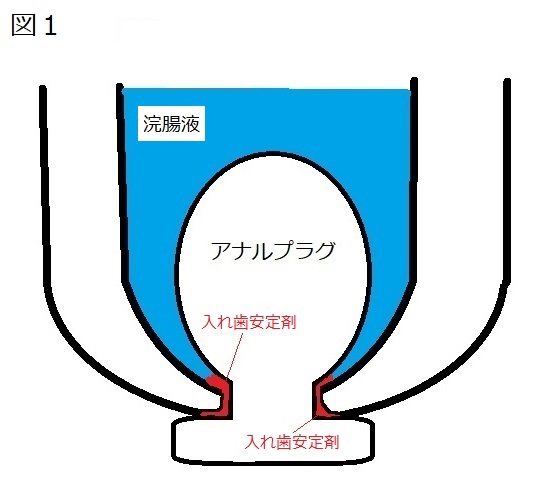 イチジク浣腸してアナルプラグで栓をする。許可が出るまでひたすら排泄を我慢するのがマゾ奴隷 | 私雨 アナル奴隷系SM調教ブログ