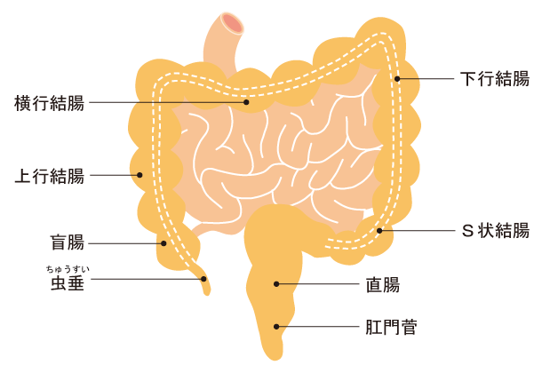 大腸がんの手術について - 消化器・一般外科 - 受診案内