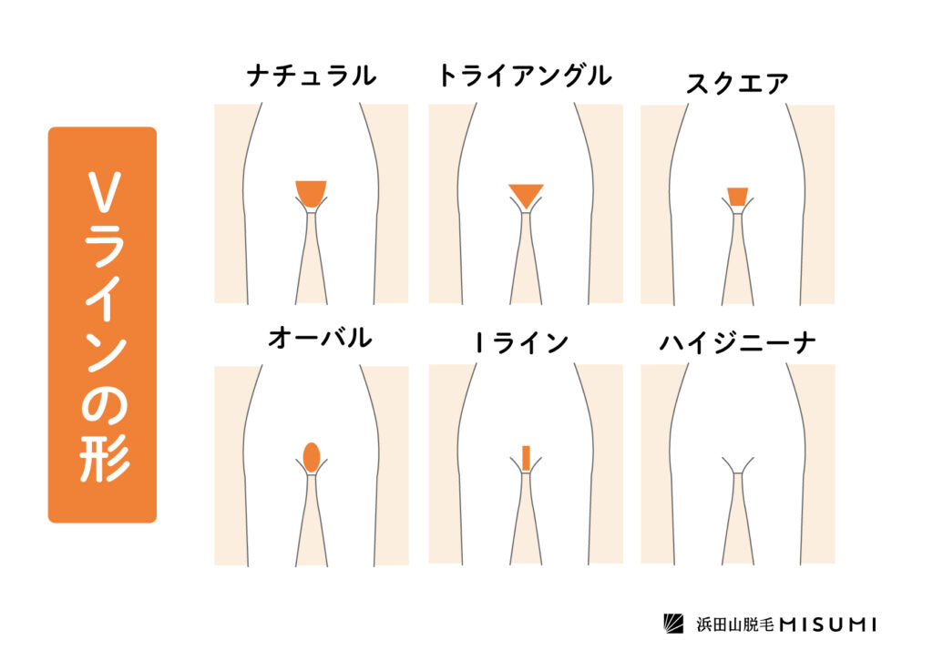 医療VIO脱毛、人気の形（デザイン）は？後悔する前に押さえておきたいこと - 【東京4院・大阪3院】美容皮膚科フェミークリニック