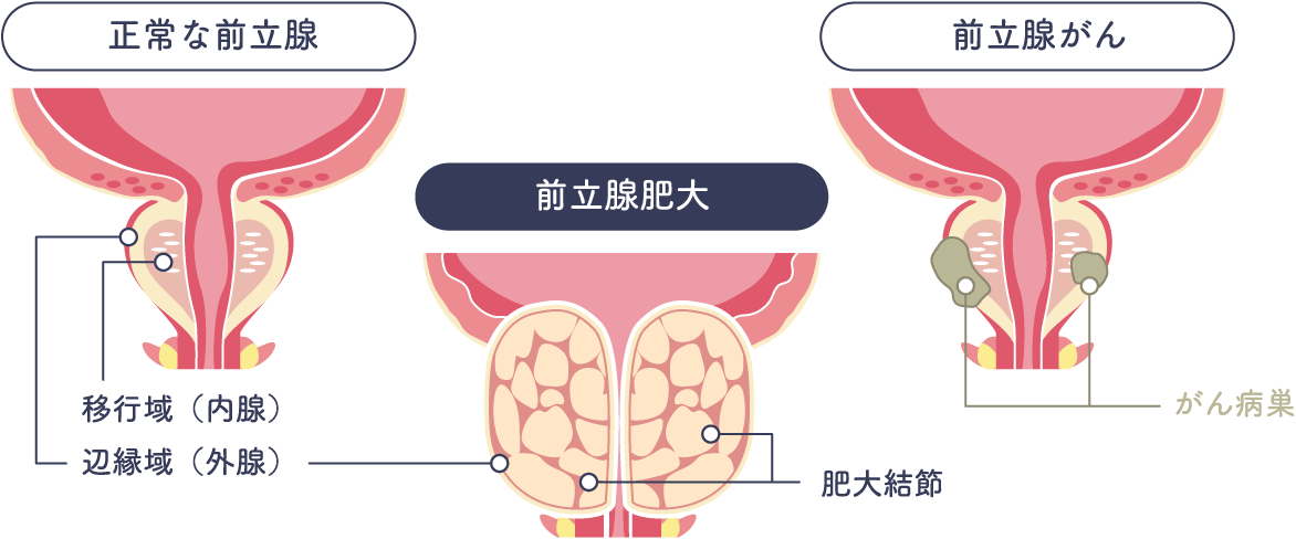 福岡ニューハーフマッサージ専門店｜Joy Healing -