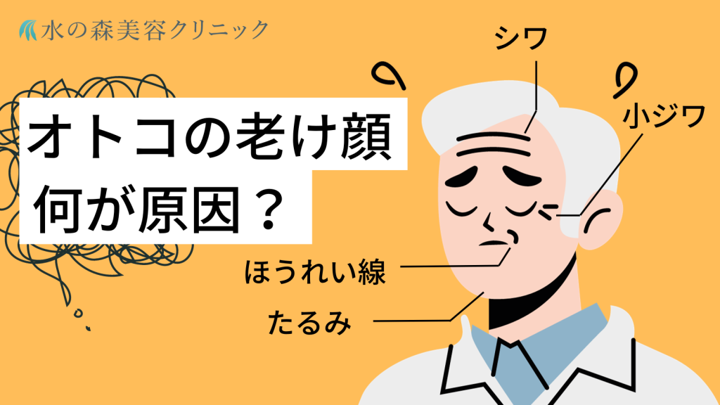 男の老け顔 3大要因「シミ、シワ、たるみ」はこうして作られる！：男の「老け顔」を解決！：日経Gooday（グッデイ）