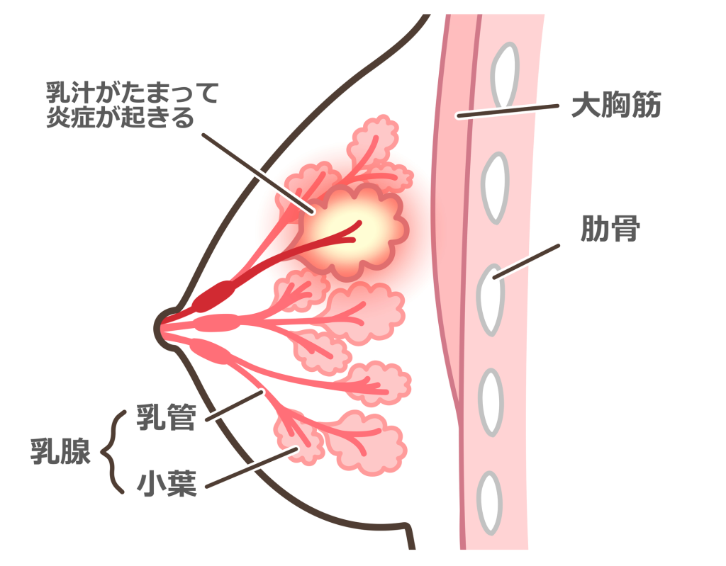 ♪1000円クーポン♪搾乳機 電動 母乳 さく乳器 搾乳器