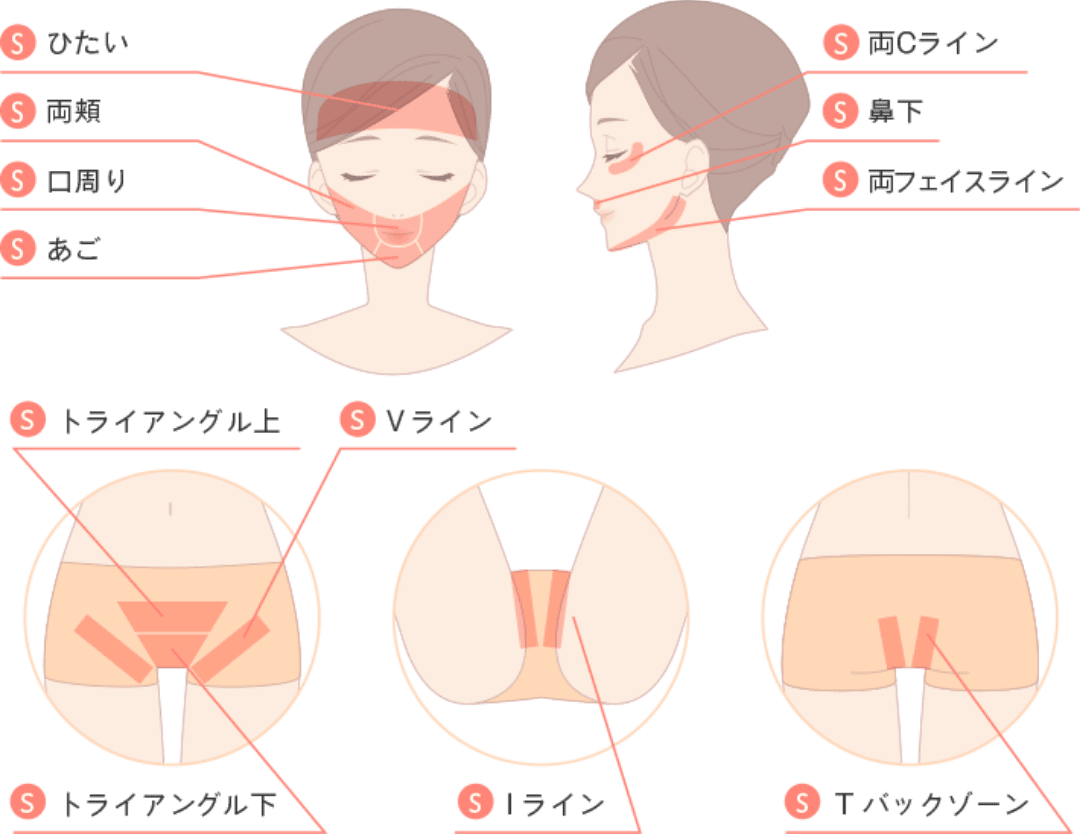 錦糸町の脱毛サロン全19店舗！安くて口コミでおすすめ3選は？│東京医療脱毛ガイド