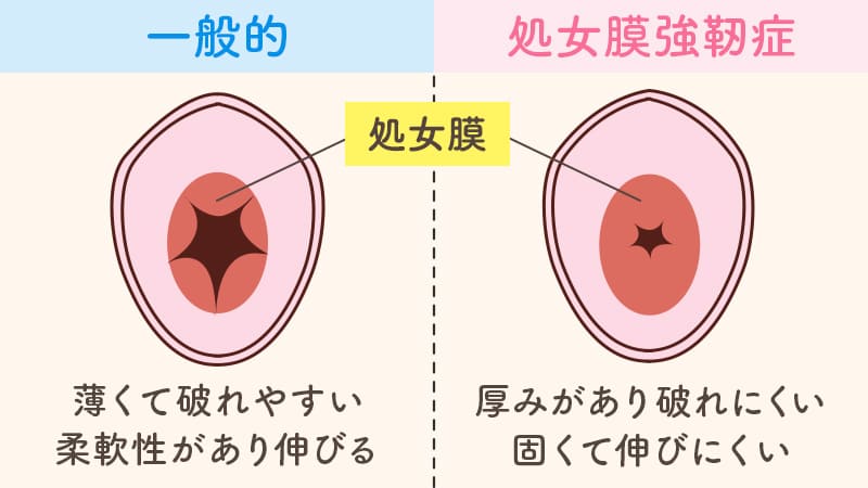 【※今すぐ見て】膣の奥が痛い本当の原因は実は●●かも【婦人科形成医が解説】