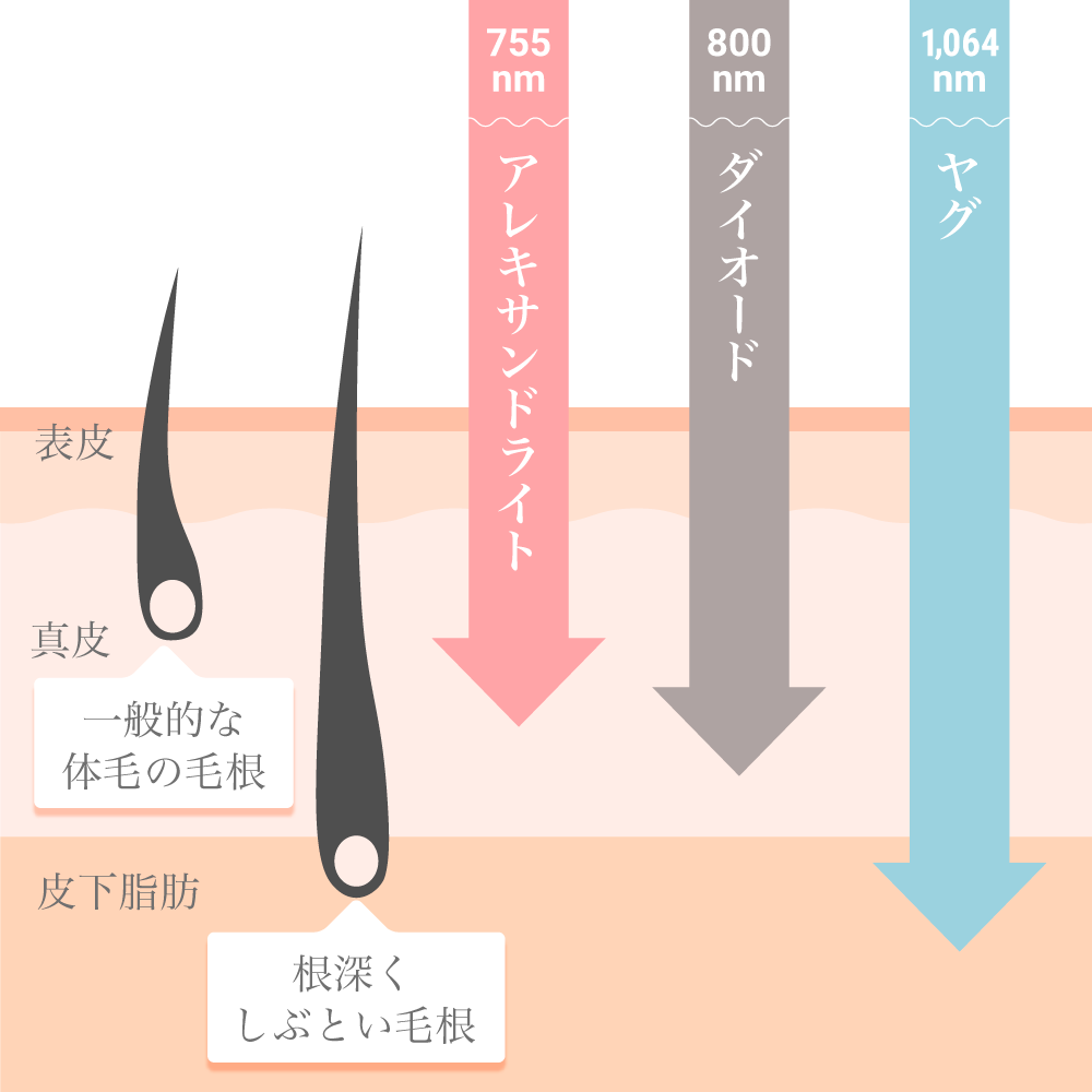 麻雀 パイパン (36個セット）自分流にアレンジ