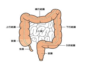 大腸ポリープを理解するために