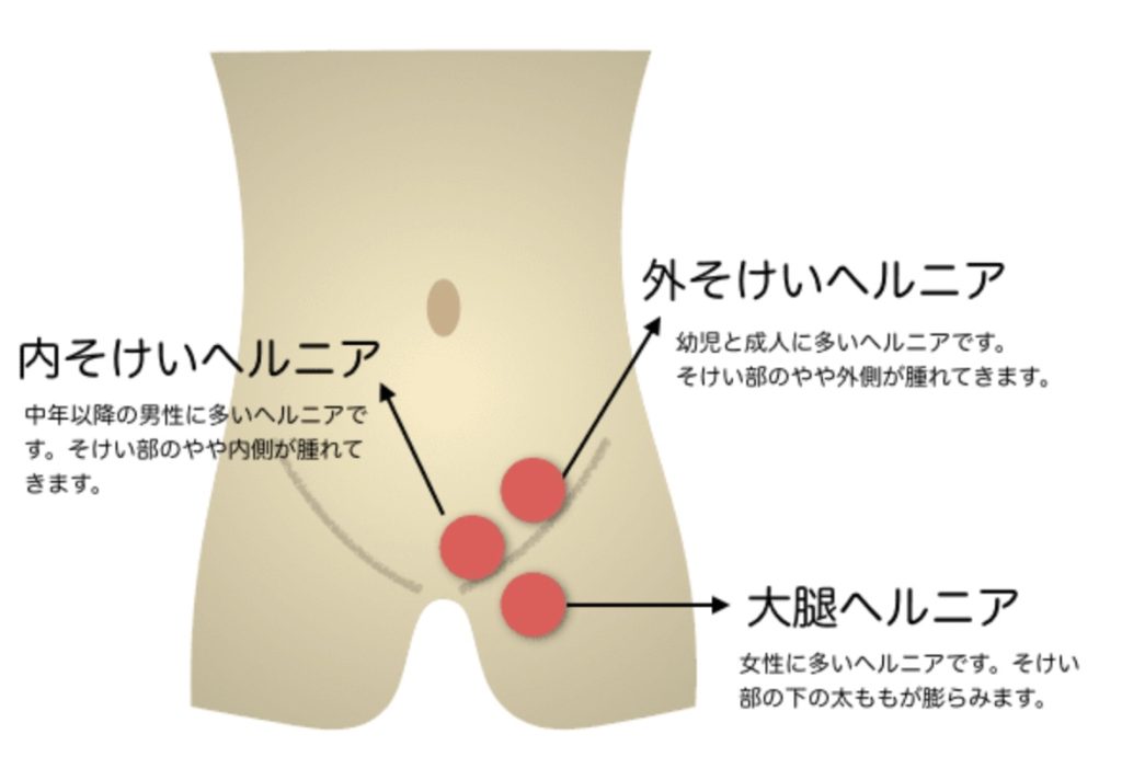 楽天市場】鼠径部 締め付けない ショーツ 綿 レディース