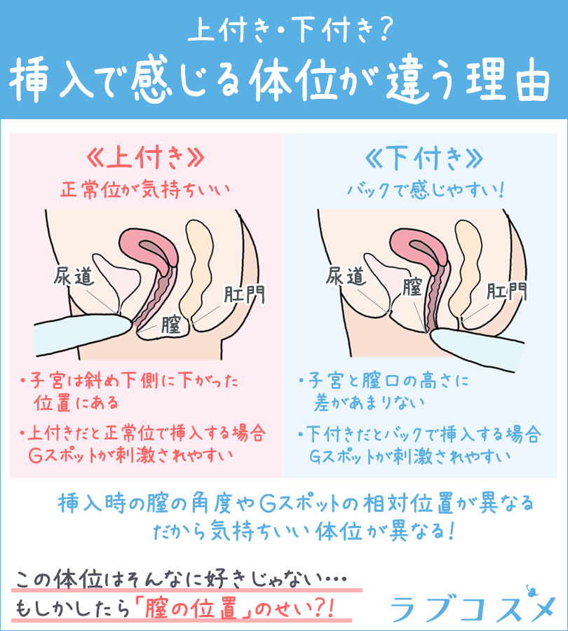 盛りマン（土手高）とは？原因やメリット・デメリットなどについて紹介！｜風じゃマガジン