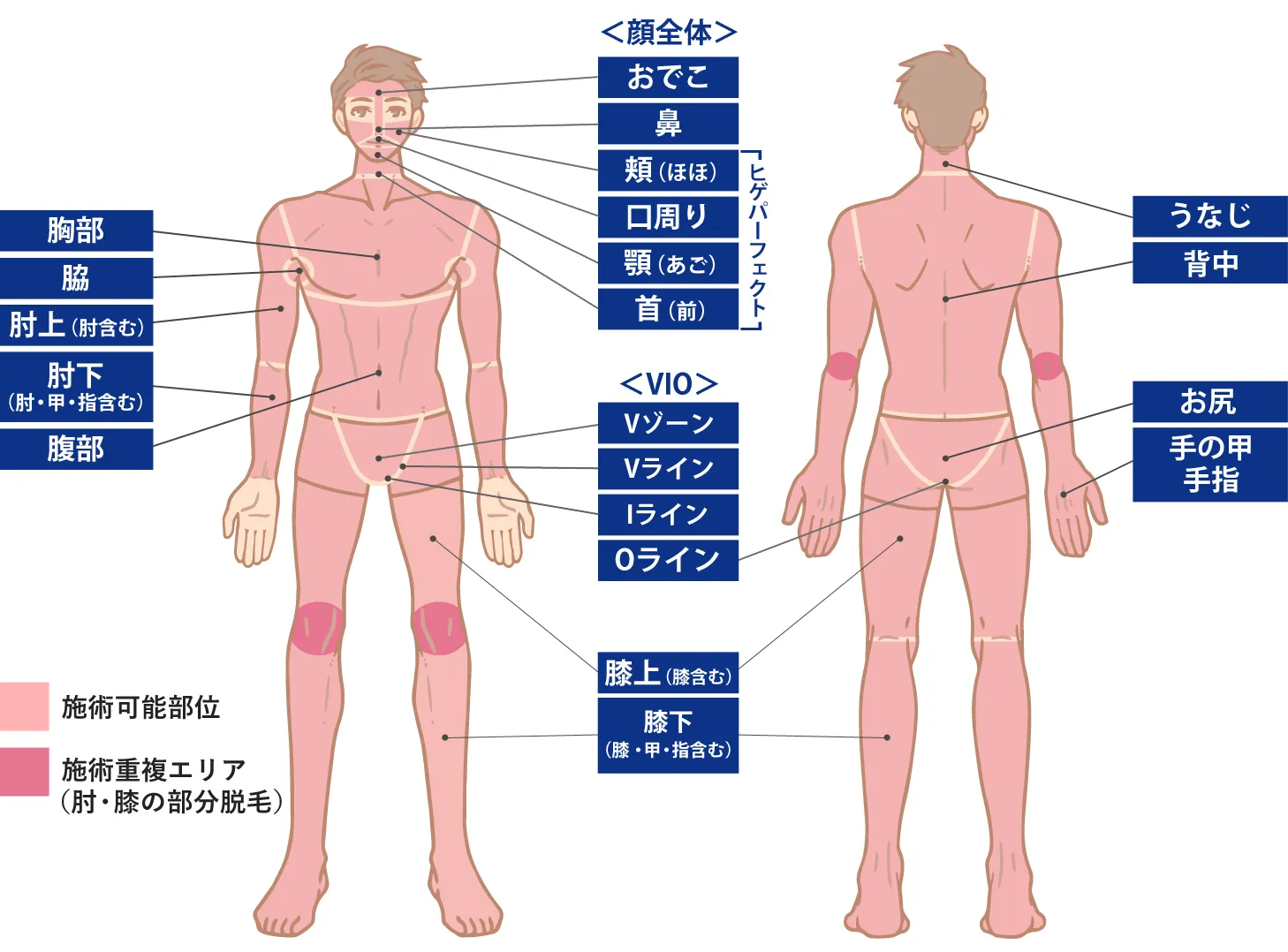 神戸でおすすめの【ヒゲ・全身】メンズ脱毛サロン・医療クリニックを紹介！ | メンズ脱毛ラボ