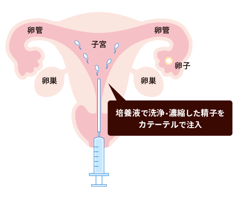 すごい…奥まで挿入ってるっ」たまらず絶頂!? レンタルイカせるだけの人【フルカラー】 1巻｜無料漫画（マンガ）ならコミックシーモア｜タカヤマノン