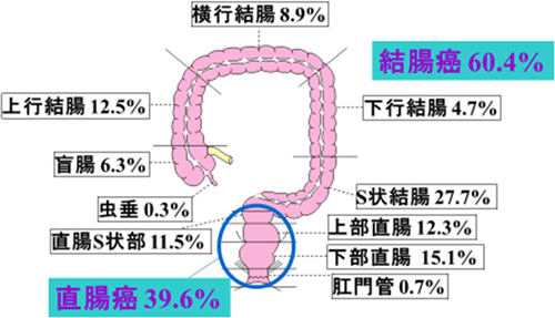 お腹が急にぎゅるぎゅる」ストレスだけが原因ではない!? 医師が解説、「過敏性腸症候群（IBS）」の4つの原因 | ダ・ヴィンチWeb