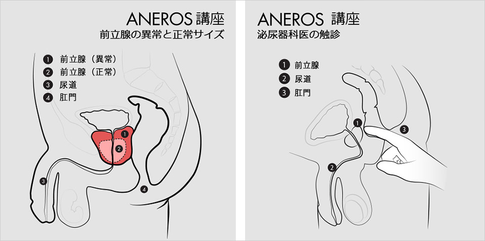 指でアナルイキ】アナルセックスでケツイキさせる方法【前立腺の刺激方法と前兆】 - エロいアナル大好き！アダルトアブノーマルな出会い