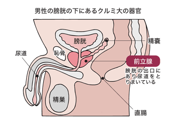 Byrhinio-磁気パルスタイプの男性バイブレーター,前立腺マッサージバイブレーター,男性の性的パフォーマンス製品,RBX-3/RMX-4 - 