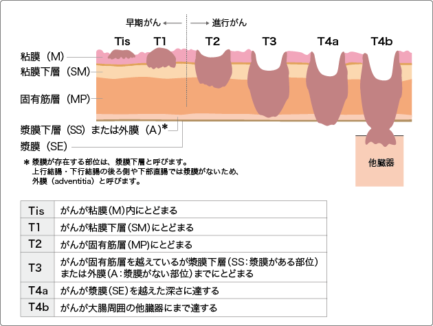 大腸の解剖用語 (ガストロ用語集 2023 「胃と腸」47巻5号より)｜gastropedia（ガストロペディア） 消化器にかかわる医療関係者のために