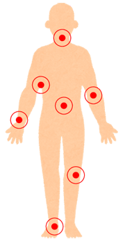 🫧なぜくすぐったいのか🫧 突然ですが、体を触られた瞬間くすぐったいと感じたことはありませんか。 それは「身体の不調の証拠」かもしれません！！ 