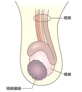 医師監修】【動画付き】危険なオナニー（自慰行為）のやり方7選|意外と知らないED治療薬がもたらす効果とは｜イースト駅前クリニックのAGA治療