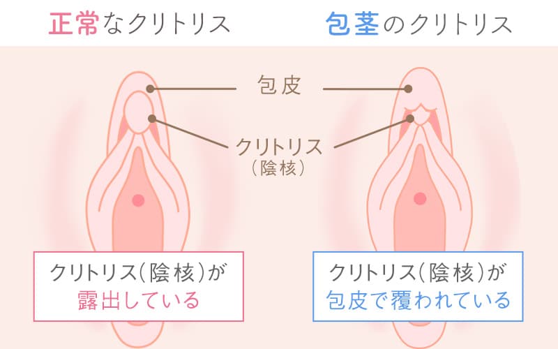 幸せなのは許せない！本当にあった残酷すぎるクリぼっちの悲惨体験談｜一番怖いのは女の嫉妬 - LoveBook