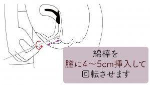 性病は予防することができる！安全に性行為を行うために大切な7つの方法 - ココロ薬局コラム