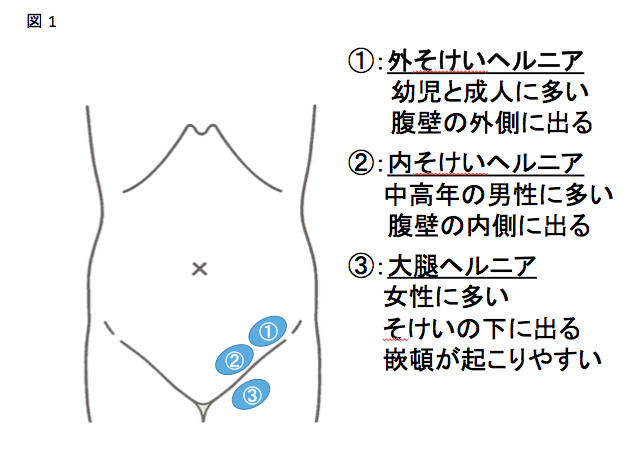 奈良市 パーソナルトレーニングジム/ ピラティスリフォーマー特集、股関節を正しく使えることで膝の痛みにも効果あり！！