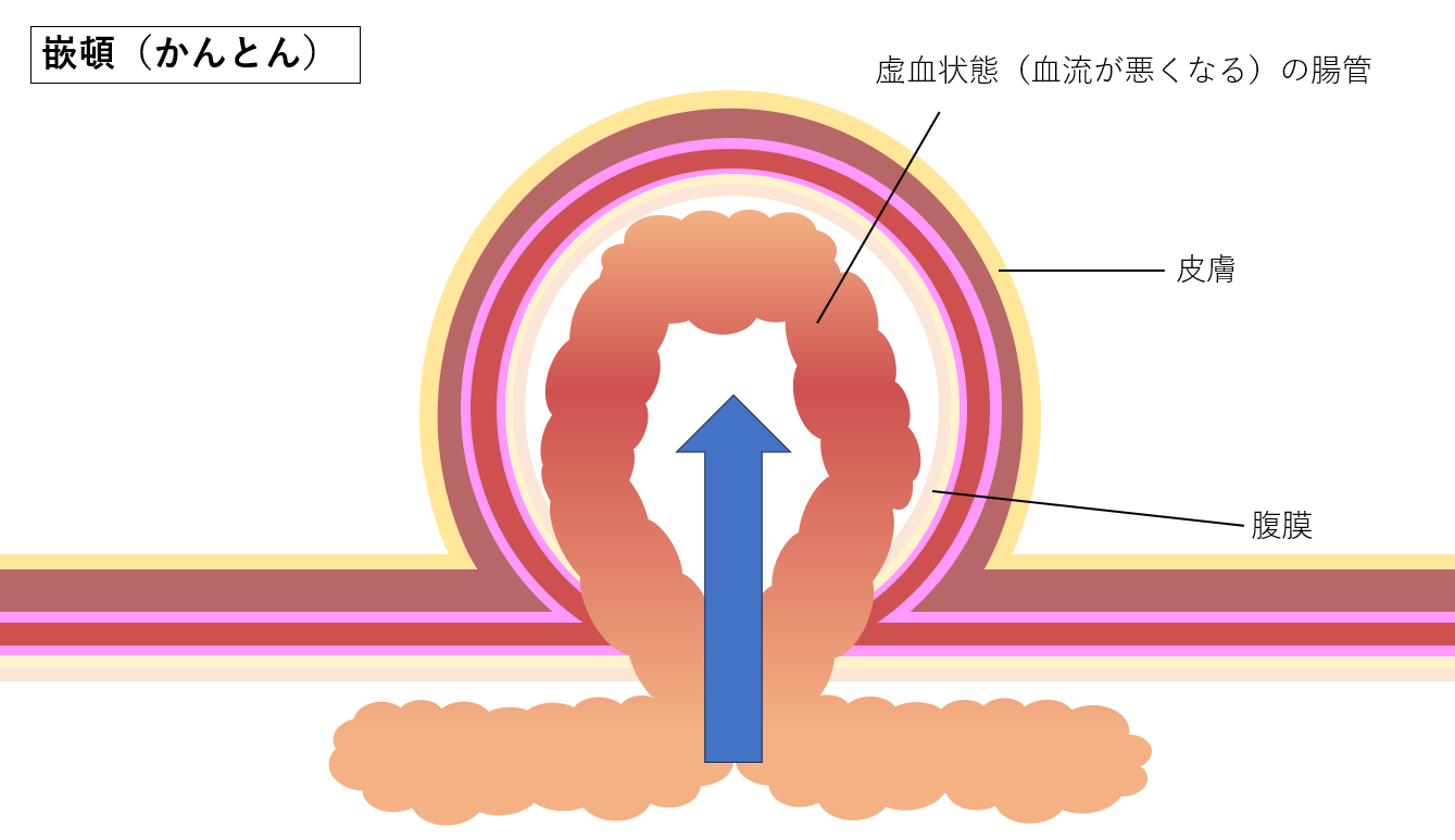 毛孔性苔癬」もうこうせいたいせん について｜Blog｜倉敷平成病院 婦人科・美容外科・形成外科・乳腺甲状腺科（岡山県倉敷市）