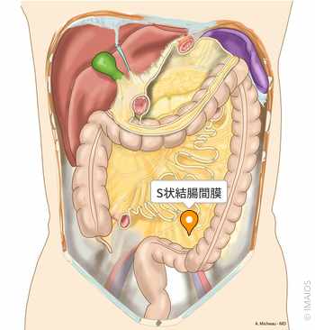 S状結腸憩室症 大腸憩室症の教科書を執筆しました |