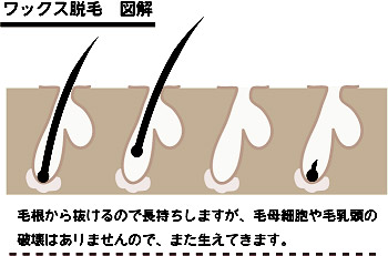 メンズ(男性)のヒゲ脱毛とは？エステと医療の違いから、価格・効果・回数・痛みなど全てを解説。