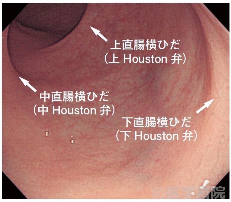 腹腔鏡下S状結腸切除術ハンズオントレーニング[DVD付]: 動画でわかる徹底レクチャー | 伊藤 雅昭,