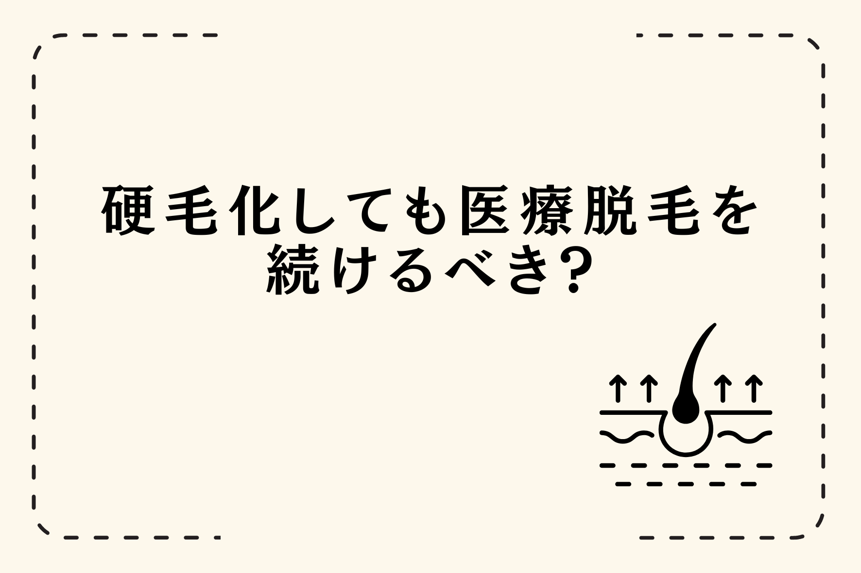 ジムに通う男性は脱毛するべき？！トレーニングのために脱毛した男性のホンネを調査！ | 株式会社リンクスホールディングスのプレスリリース