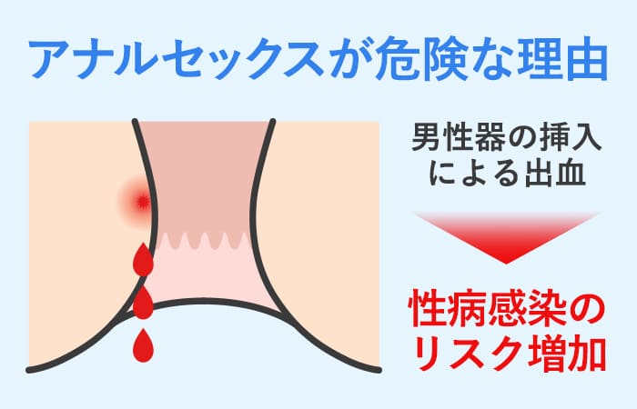 メスイキするためのアナルの性感帯の種類＆開発方法について | アネドラ