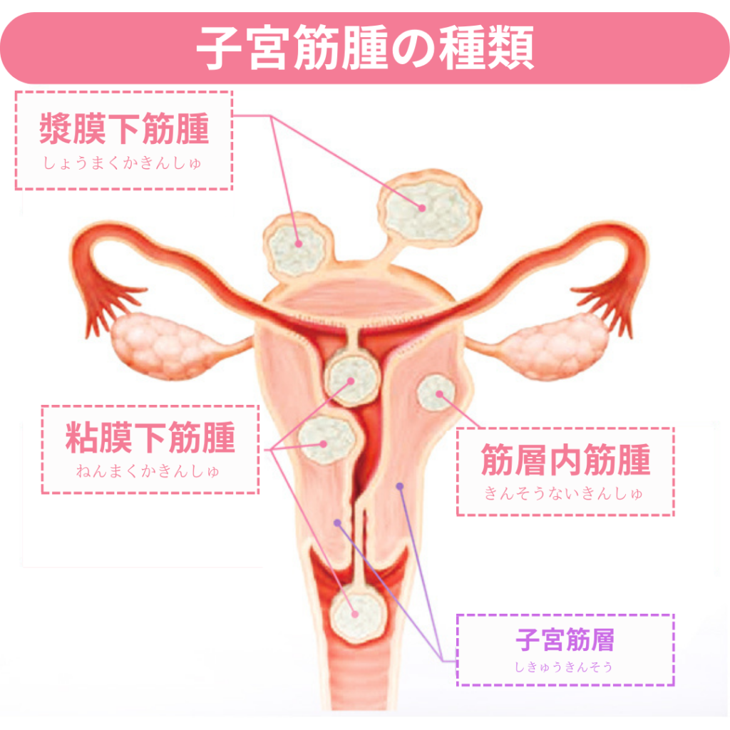 オナニーでニキビができやすくなる原因と対処法！おなニキビを作らない！ | ザヘルプM