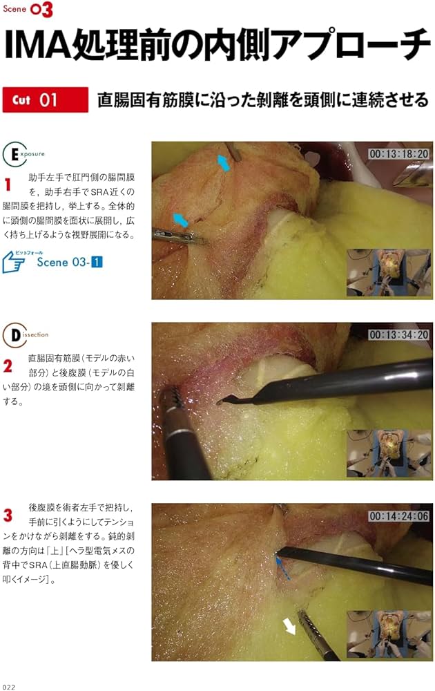 ヒルシュスプルング病（先天性巨大結腸症）［私の治療］｜Web医事新報|日本医事新報社