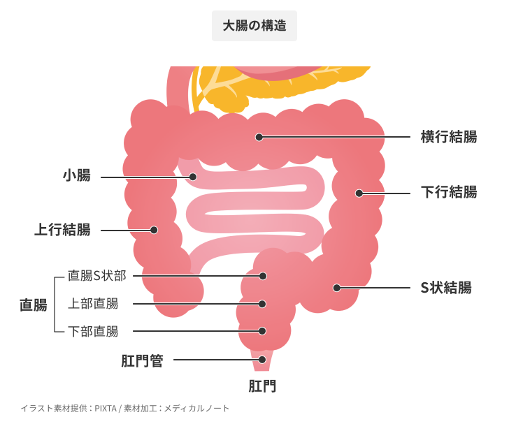 新型大腸内視鏡モデル-mikoto- : 水浸法による無痛大腸内視鏡挿入マニュアル