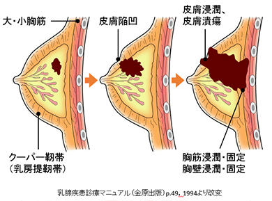 胸のGスポットで胸イキ！スペンス乳腺開発 - 夜の保健室