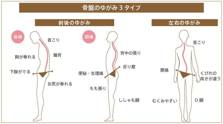 整骨院ってどんなところ？整体院・マッサージ店との違いについて詳しく解説 - CureCare(キュアケア) 痛みの改善から予防までを届けるメディア