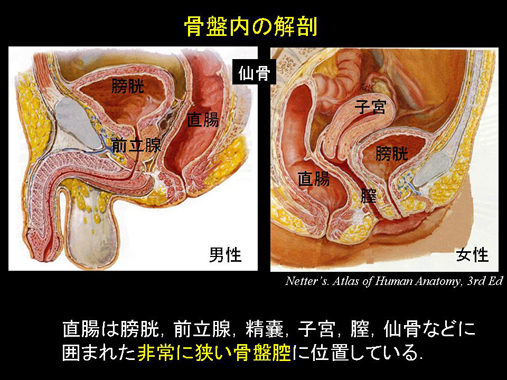 アナルプラグ ペニスリング付き 前立腺マッサージ器 リモコン付き