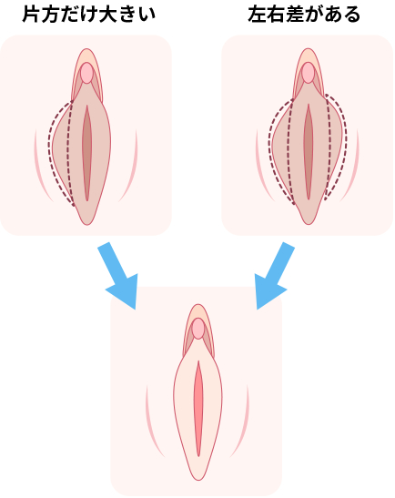 クリトリスの皮を剥くコツは？クリイキするための正しい剥き方をイラストでチェック