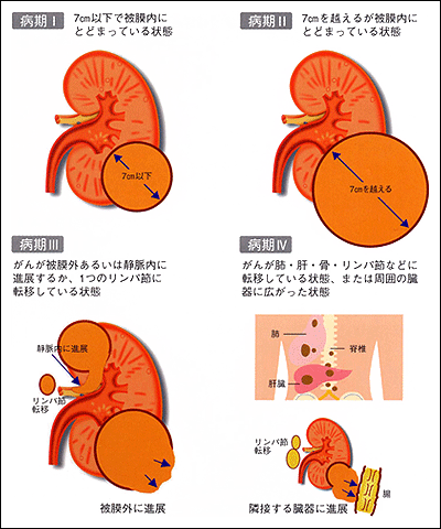 性病・水前寺皮フ科医院｜熊本市の皮膚科・形成外科・アレルギー科