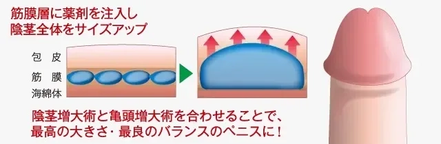 ちんこから赤のが吹き出た と思ったら途中から二股に分かれ 肩の高さまで飛んだ | 写真で一言ボケて(bokete)