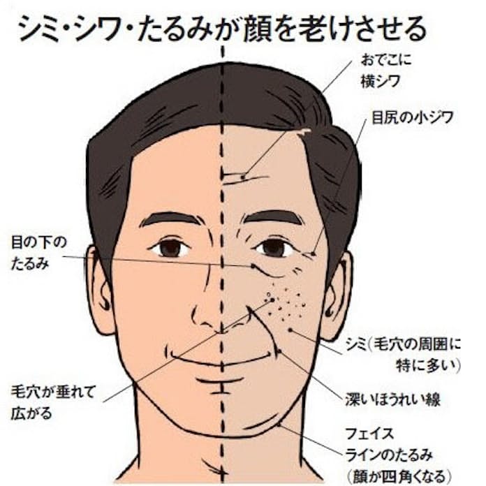 男の老け顔の原因は？効果的な改善方法とおすすめの美容医療をご紹介｜水の森美容クリニック