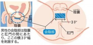 強制男の潮吹き性感治療院 池袋東口/デリヘル -