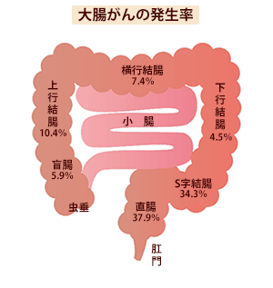 S状結腸リンパ節 - e-Anatomy -