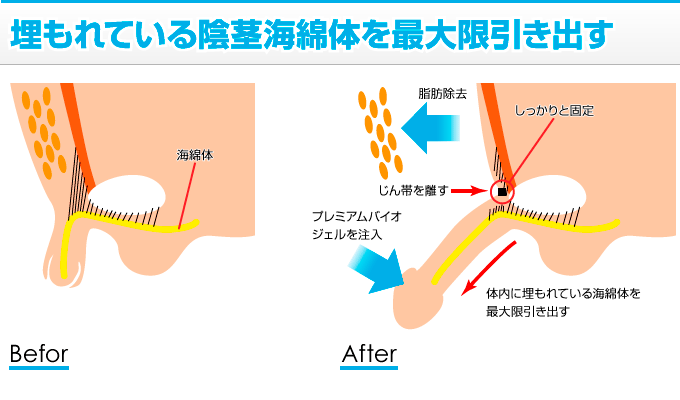 コンドームのサイズの測り方！ずれる対処法【医師監修】 - 夜の保健室