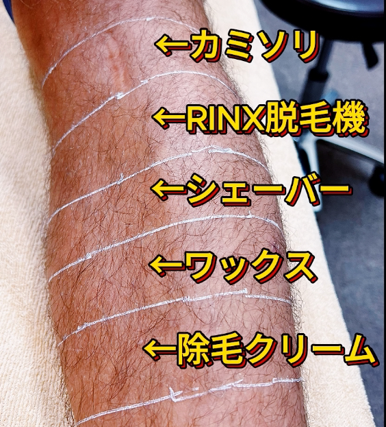 RINX（リンクス）の本当の評判は？脱毛効果や施術に関する口コミの真実、料金を徹底調査