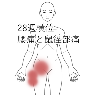 鼠径部痛症候群（グロインペイン症候群） ｜SPORTS MEDICINE LIBRARY｜ザムスト（ZAMST）