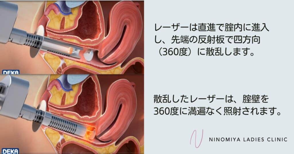 女性に多い】膀胱炎の原因から症状・治し方まで解説 | ひまわり医院（内科・皮膚科）